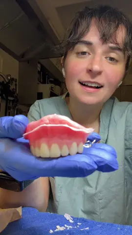 It is dooooone!! :D #maxface #obturator #dental