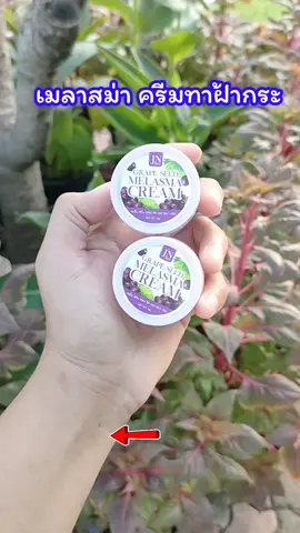 ุึุ#jn #melasma #เจเอ็นสกิน #เมลาสม่า #ครีมทาฝ้า 
