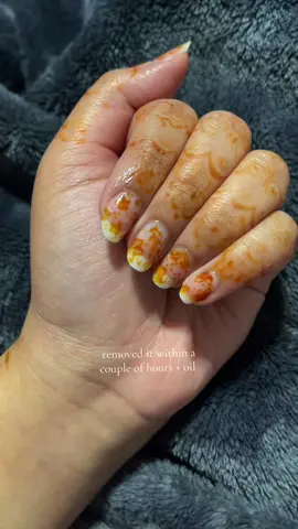 I did use really old henna tbh bcs i didn’t want the stain to last if I didn’t like it, I think I would’ve liked the designs more without so all those dots. the design would’ve  looked cleaner imo. also don’t mind my skin peeling 😭🥲