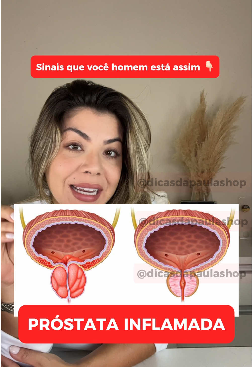 O óleo de semente de abóbora inibe a enzima 5-alfa redutase, que converte testosterona em DHT, ajudando no tratamento da queda de cabelo (alopecia androgenética), que é causada pelo excesso de DHT. Além disso reduz a inflamação da próstata devolvendo bem estar e autoestima 🍆😩🙏 #inflamacaodaprostata #sementedeabobora #saudemasculina #novembroazul 