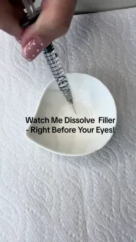 Ever wondered how we dissolve filler? Watch this unedited, uncut video until the end #fillerdissolve #dermalfiller 