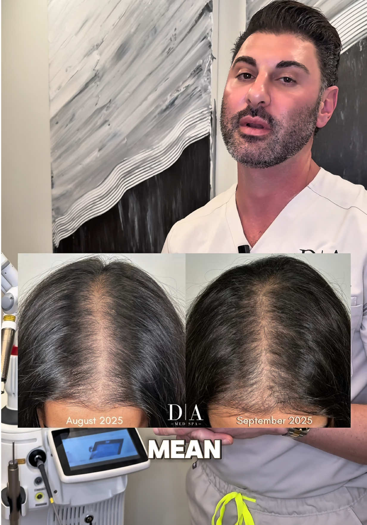 Are you dealing with hair loss? #hairloss #hairgrowth #hairgrowthjourney 