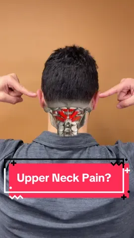 Neck pain that just won’t quit? 👇 Try this quick test:  1️⃣ Bring your head forward and look up, hold for up to a minute.  2️⃣ Bring your head forward again, but this time look down, and hold for a minute.  Whichever one reproduces your pain tells you what’s going on.  👉 If it hurts when you look up, nerves, blood vessels, and deep neck muscles are being compressed.  👉 If it hurts when you look down, the muscles that control your head-lowering movement are weak. Now let’s fix both sides of that equation. For compression: place your hand on your chin and gently pull your head straight up — feel that lift? You’re decompressing the tight muscles that trap your nerves. You can even tilt slightly to each side to release deeper tension. Then practice slow tucks and tilts side to side to restore control and alignment. For weakness: use your fingers on your forehead to assist your head down, then lift it back up on your own. You’re retraining the deep flexors that hold your head up properly. And once you've done that, finish by rebalancing your upper body. Sit tall, stretch through your chest and shoulders, then lay on a foam roller — arms overhead, shoulder blades pulled down and back — and repeat reps to strengthen posture support muscles. 💡 Over time, these movements restore proper balance between flexibility and strength so your neck can finally relax, your headaches ease, and your head feels clear again! #neckpain #headache #brainfog #posturecorrection #mobility     