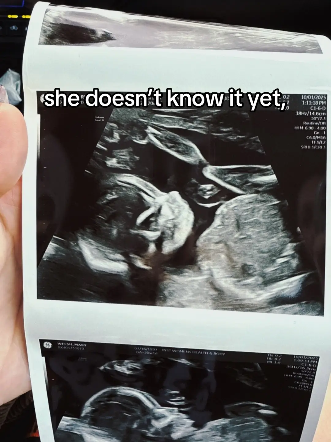 she doesn’t know it yet but i am excited for all of the things we get to experience together 🤍🎀✨ #pregnant #pregnancy #firstimemom #girlmom 