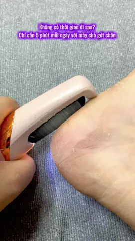 #chamsocchan #gotchan #maychagotchancaocap #maychagotchancamtay #maychagotchan 