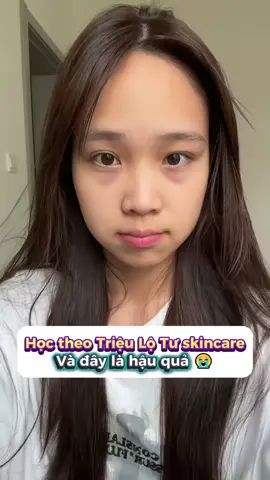 Hậu quả của việc skincare theo Triệu Lộ Tư #lamdep #skincare #chamsocda #meolamdep #beautytips 