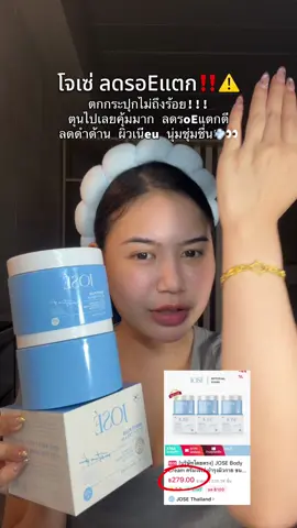#jose #ลดรอยแตกลาย #ครีมโจเซ่ 