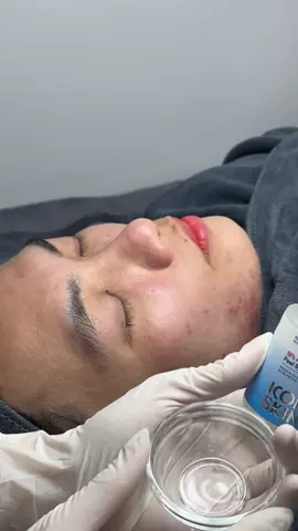 Nhớ là điện thoại thì reset xong có thể lỗi chứt xíu, còn da peel xong thì chỉ có đẹp hơn thôi nha😍#xuhuong #chamsocdakhoahoc #Peelmunkhongbong #duocmyphamchinhhang #ChamSocDa 