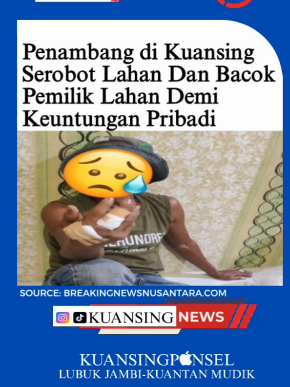 kejadian Nahas yang di alami warga Desa Pebaun Hulu, Kecamatan Kuantan Mudik, kabupaten kuantan singingi, Riau, Pembacokan Oleh Pekerja PETI pada hari minggu 21 September 2025 lalu. Aprisal Alias Andin Seorang bapak pemilik lahan ini harus menerima perawatan di Tangan akibat menegur Penambang Emas Ilegal (PETI) Menyerobot Lahan miliknya. Namun Malang tak dapat ditolak, Seorang Pekerja PETI tersebut menghampirinya dan menganiayanya dengan Sebilah Parang, hingga mengakibatkan Tangan Terluka. “Diduga Pemilik PETI tersebut seorang oknum coklat bertugas di Pekanbaru. Anggota yang membacok inisial PJ bg”, ujar AS ke Media ini. Lanjut As “Laporan sudah masuk ke Polsek Kuantan Mudik, bisa abang klarifikasi dengan Kapolseknya langsung”. Masyarakat menduga bahwa adanya upaya menghilangkan perkara, masyarakat juga kesal, kenapa hingga saat ini pelaku belum juga di tangkap, ada apa dengan Aparat Penegak Hukum. “Diduga ada tekanan dari pemilik PETI kepada Polsek Kuantan Mudik, sehingga Beritanya di Redam, dan Perkaranya di diamkan, padahal Laporan sudah masuk di Polsek Kuantan Mudik”, Ucap Warga ini, Selasa (07/10/2025) Malam. “Pelakunya belum juga di tangkap, barang bukti sebilah parang yang sudah di aman kan di Polsek Kuantan mudik, Diduga Barang Bukti tersebut sudah di hilangkan, Hukum di permainkan, minta pertanggungjawaban Kapolsek Kuantan Mudik”, lanjut dengan nada kesal warga ini. Media ini mencoba menghubungi kapolsek kuantan mudik via Whatsap, hingga berita ini di terbitkan kapolsek kuantan mudik belum ada tanggapan. SC : Breakingnewsnusantara.com #beritakuansing #virall #news #kuansing #kuansingnews 