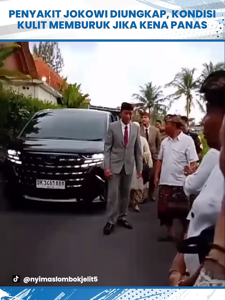 Akhirnya Penyakit Jokowi Diungkap Ajudan, Kondisi Kulit Memburuk Jika Kena Panas BANJARMASINPOST.CO.ID - Viral di media sosial potret terbaru Presiden RI  ke-7 Joko Widodo bersama sang istri Iriana Jokowi menjadi sorotan.   Potret terbaru Jokowi ini disorot lantaran kondisi kulitnya yang  terlihat makin putih  Ajudan Presiden, Kompol Syarif Muhammad Fitriansyah, menjelaskan bahwa  Jokowi saat ini masih dalam masa pemulihan dan disarankan oleh tim medis  untuk menghindari kegiatan di luar ruangan.  “Saat ini beliau masih proses pemulihan, dan dianjurkan agar tidak  mengikuti kegiatan di luar ruangan yang terkena panas,” kata Syarif,  melansir dari Kompas.com.  Menurut Syarif, kondisi kesehatan Jokowi belum sepenuhnya pulih akibat  penyakit alergi kulit yang sempat dideritanya beberapa waktu lalu.  Karena itu, Presiden diminta membatasi aktivitas yang berpotensi  memperburuk kondisi kulitnya, terutama paparan langsung sinar matahari  Kompol Syarif Muhammad Fitriansyah juga turut memastikan bahwa kondisi  Jokowi bukan penyakit berat, melainkan hanya alergi kulit biasa.  (Tribunjatim)