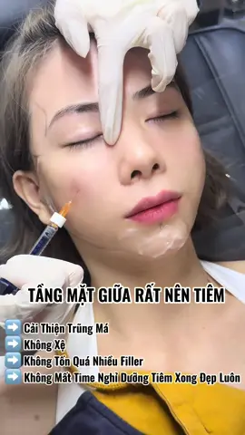 #tiêm_filler #viral #xu #filler #douyin_china 