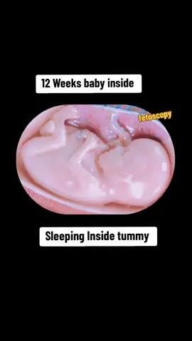 12 weeks pregnant #babyinbelly😍 #babyinwomb☺ #babysleeping #ultrasoundscan #12weekspregnant 