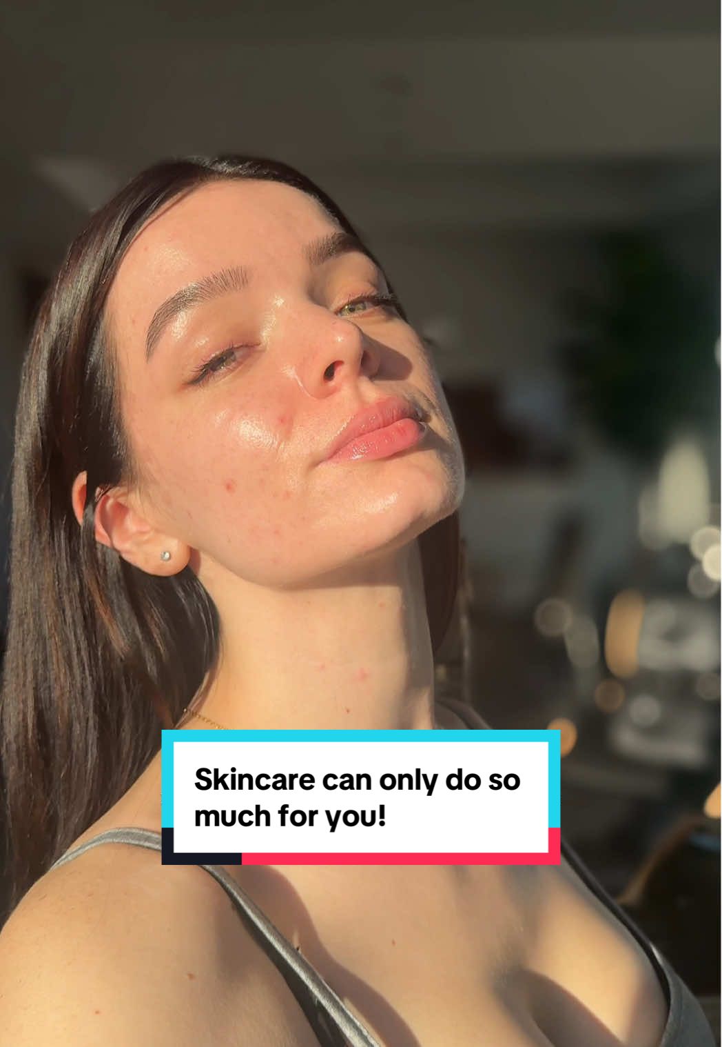Skincare only goes so far, so these are a few things I consider when I start breaking out (especially outside of my cycle)👇🏼 🩸 Balance your hormones naturally – support your cycle through adequate sleep, stress management, and healthy fats. 🥗 Prioritize whole, nutrient-dense foods – focus on fiber, greens, and protein to help regulate blood sugar. 💧 Stay hydrated – water helps flush out toxins and support liver function. 🧘🏻‍♀️ Manage stress – high cortisol can trigger breakouts; focus on low intensity workouts and centering yourself.   💤 Get enough sleep – your skin repairs itself overnight, so don’t skimp on rest. 🧠 Check internal health – consider gut health, thyroid, and possible nutrient deficiencies. I’ve wanted to get ALCAT test to navigate what may be causing inflammation in my body. #hormonalacne #acnetips #skinfromwithin #acnejourney #pcosawareness 