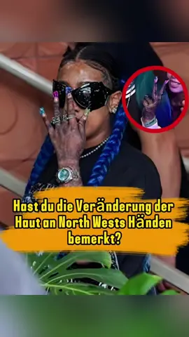 Hast du die Veränderung der Haut an North Wests Händen bemerkt? #fyp #celebrity #northwest #blueivy #kimkardashian 