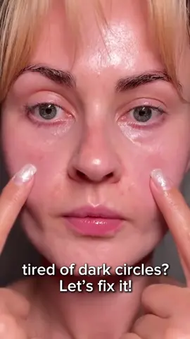 Dark circles?vanish,please!#retinolskincare #skincarethatworks #antiaging #eyecream #fyp 