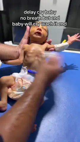 Prayers needed for the Baby #goviral #foryou  #babies #trending  #foryoupage 