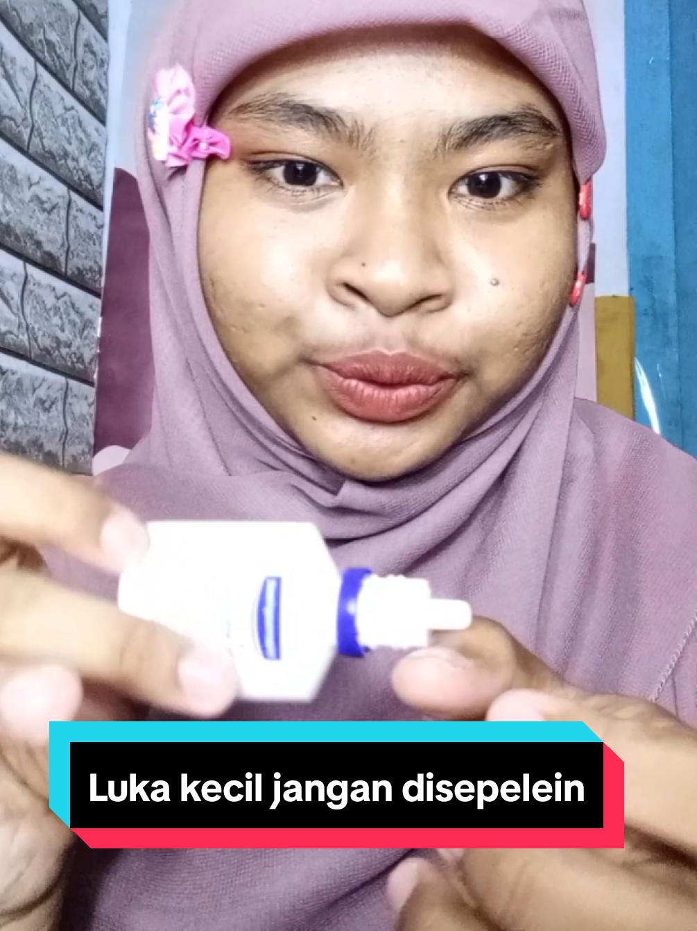 ada luka dikit ga khawatir tinggal pakai Hansaplast Antiseptik tetes dan Hansaplast Plester beb hihi 😋🫶 @hansaplast_id #Hansaplast #Secondskin #HealFasterLikeSecondSkin #TenangBawaHansaplast
 #PlesterHidrokoloid 