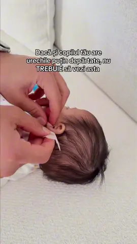 Uite cum să scapi de urechile clăpăuge în câteva secunde #urechi #foryou #fy #fyp #viral 