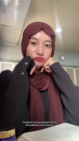 Tunjukin hasil pemakaian nyyo yuk😍🤭 @NYYO Cosmetics  #nyyocosmetics #moisturizer #nyyo #skinbarrier 