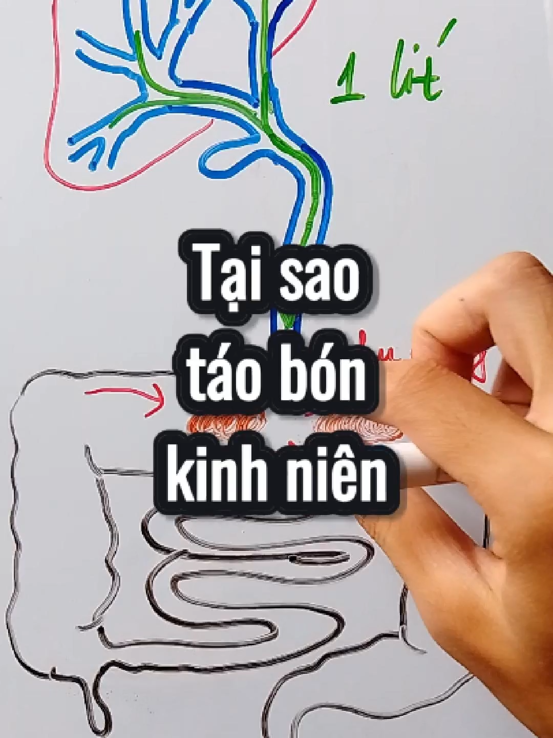 Sách giá tự do. Tuy nhiên, những ai đã mua hoặc tiếp tục mua giá gốc mình sẽ gửi thêm phần 2. #kienthuc #chiase #chiasekienthuc #suckhoe #thanhcong #hanhphuc #hyvong #chienbinh #ductin #tinhyeu #gan #soimat #viemgan #gannhiemmo #ungthugan #phauthuat #ruou #bia #taobon #daitrang #gan