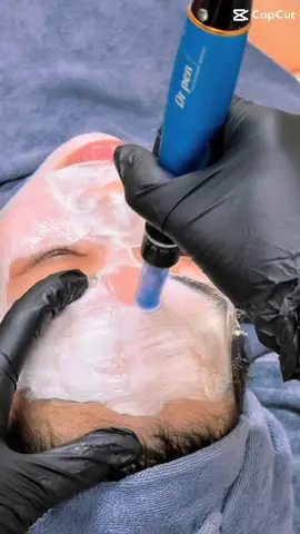 Tuần 1 lần ▪️ Nhả nắng ▪️ Bật tông ▪️ Mịn màng #xuhuong #vn #daotaohocvien #điều_trị_mụn_nám_rỗ_tàn_nhang #xuhuongtiktok 