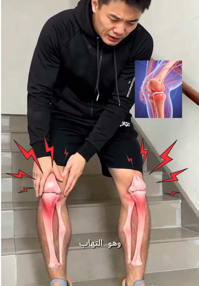 No importa dónde sientas dolor, este spray de gel de amoníaco puede ayudarte a eliminar rápidamente el dolor.#jointpain #arthritisrelief #tiktokshop #tiktok #jointhedarkside 