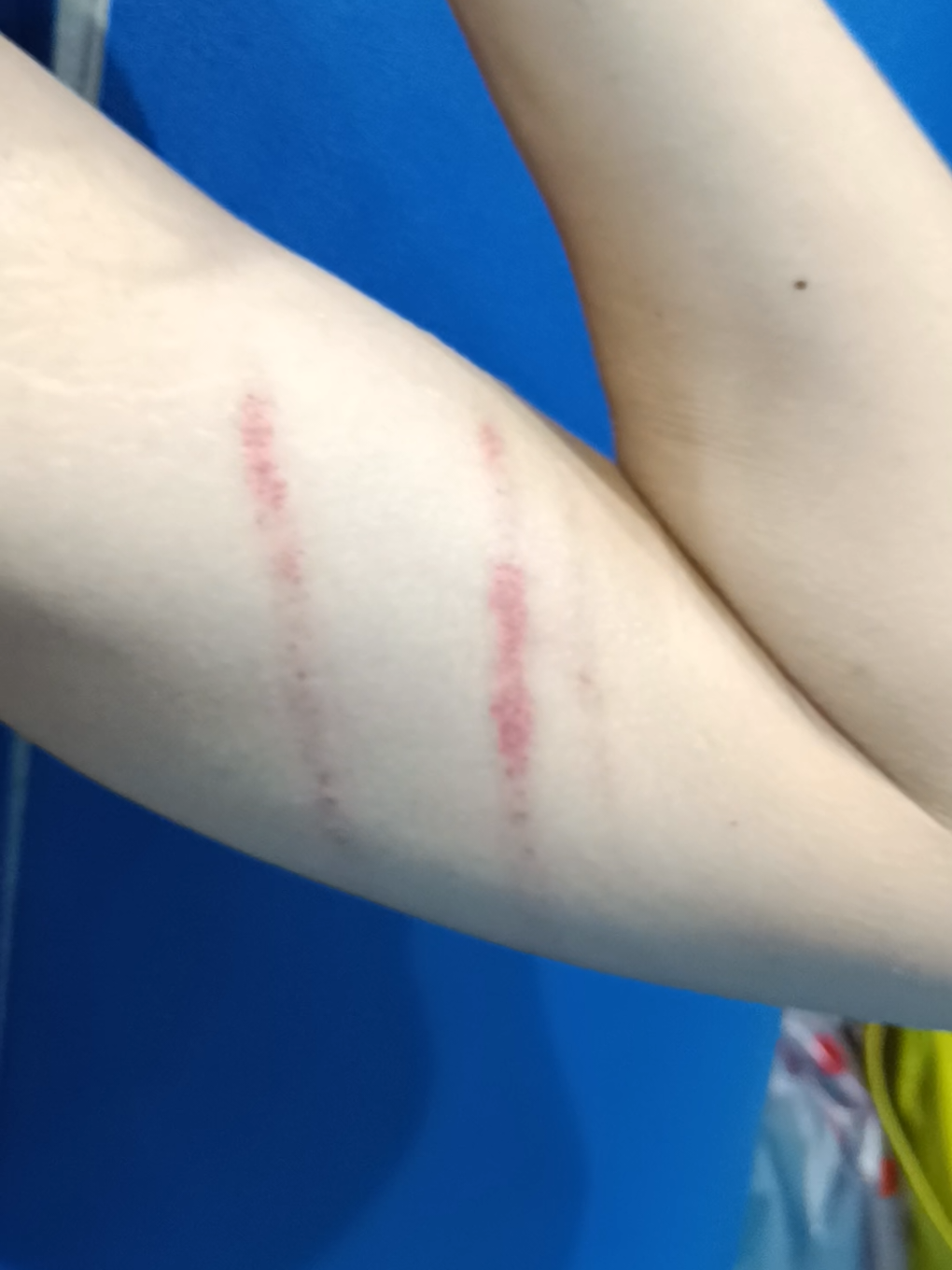 ฝากตัดเล็บกันด้วยนะครับ💅🐅 #basketball #บาส #สวนเบญจกิติ #บาสเย็น 