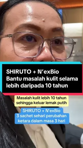 ☎️📞0182487035 su sedia membantu 💝 #suismail #aulorapants #fungus #shiruto #nexbio 