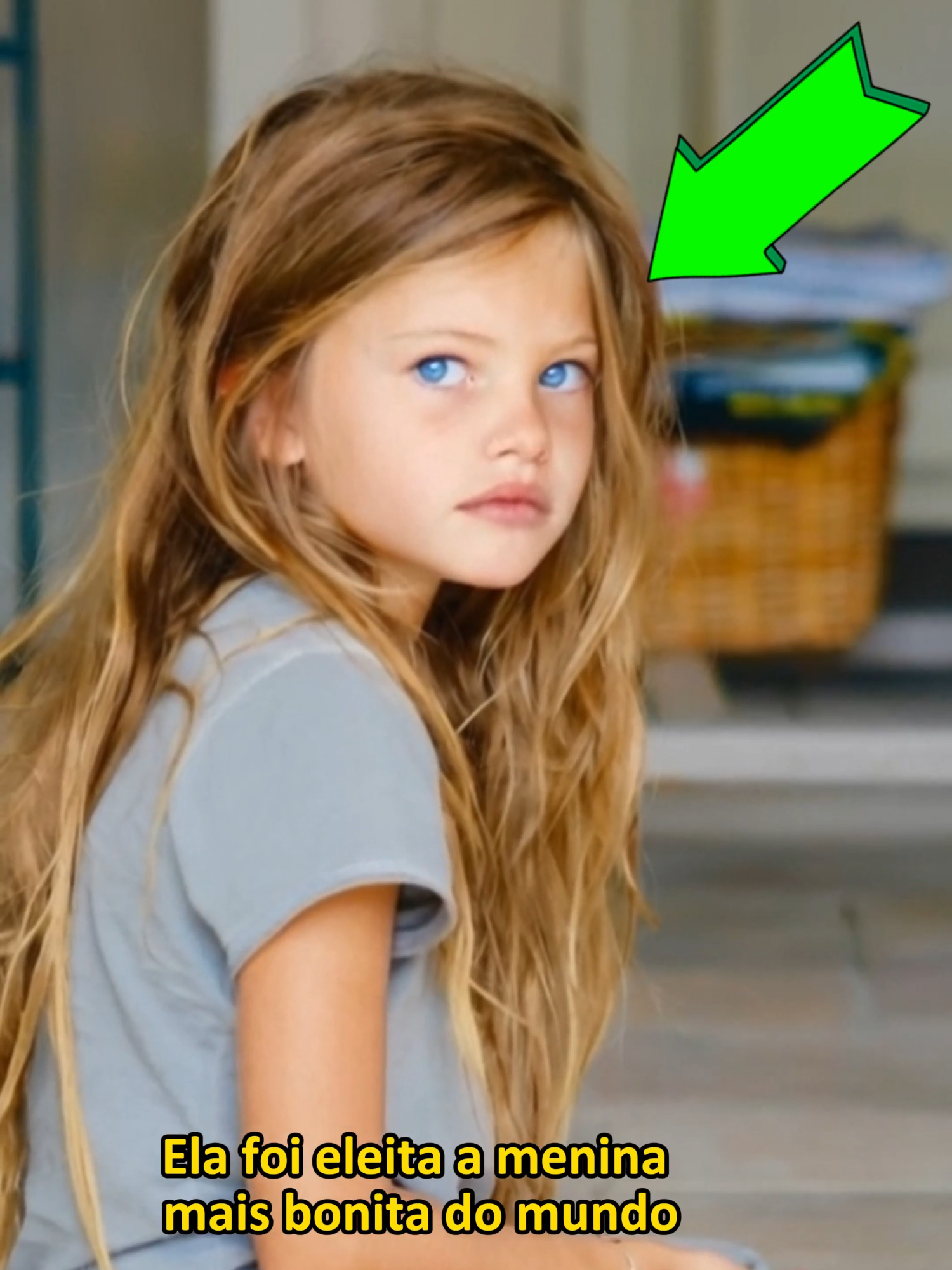 A menina mais linda do mundo hoje está assim! #historiastocantes#drama#vitoriosos#motivação#arquivomisterioso#historiasemocionantes #casosreais #gravidez #motivacional#casosemocionantes #históriasdevida #guerreirosdavida #superação #gestação #videosemocionantes#noticiasreais #entretenimento #fatoscuriosos #fatosinteressantes #casoverdade #respeitoaoproximo #noticias #dignidade