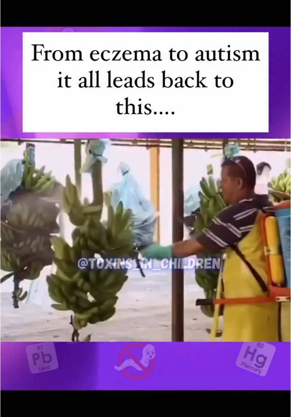 😳👇 Everything you eat fruits, vegetables, meat, cereal it’s all getting hit with something. ☠️ Sprays to keep it “fresh” 💀 Dyes to make it “look good” ☠️ Chemicals to make it “last longer” 💉 Injections to speed things up This isn’t farming It’s engineering and it’s happening to your food. But you already knew that, didn’t you? 🍏 The apple that never browns 🐥 The chicken breast that’s suspiciously huge 🌽 The cereal that practically glows in the dark It’s all part of a system built for profit, not for health. Here’s where it hit home for me: my son. His speech, his eczema, the sensory issues, the meltdowns, It all exploded when I thought I was doing everything right. Feeding him “kid-friendly” foods. Following the schedule. The routine jabs. But I started looking deeper. And what I saw made me sick. The food was toxic full of heavy metals, pesticides, added mad scientist ingredients. The medicine caused more harm than help. And his body couldn’t keep up with the daily assault of chemicals, metals, additives, and residues. They weren’t just passing through they were building up. In his gut, His skin, His brain. When I realized that it was this moment that I started supporting his body. ✅Daily detox,  ✅Real minerals,  ✅Gut repair,  ✅Parasite cleanse. Everything changed. 🟣His speech came.  🟣The eczema cleared.  🟣The meltdowns eased. And no it wasn’t magic. It was minerals. It was removing what didn’t belong. They’re not just disrupting our children’s bodies. They’re hijacking their futures. Start clearing it out. ⛔️ Not once a year ⛔️ Not when things feel off 🟢 Daily because the damage is daily If you want to know what changed everything for us, Comment MINERAL and I’ll send it straight to you. Make sure you’re following me @toxins_in_children so I don’t miss anything from me