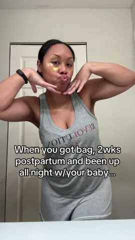 Eye patches please fix these bags😂😂😂🥱🥱🥱 #laughs #fyp #eyepatches #postpartum #newborn 