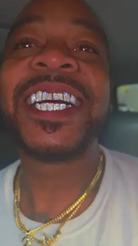 #grillz #diamond #dancing #lightshow #fyp 