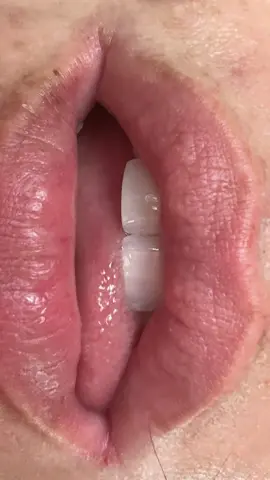 #asmr #mouthsounds 