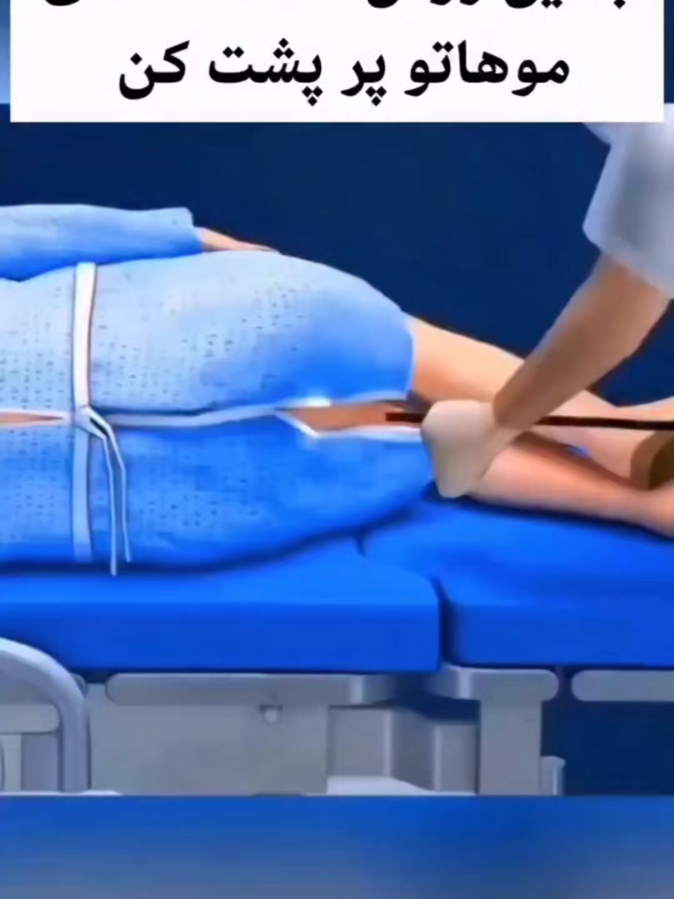 ⁨	آقایون خیلی خیلی ببخشید  ولیمعجزه پرپشتی موهاته! ‪