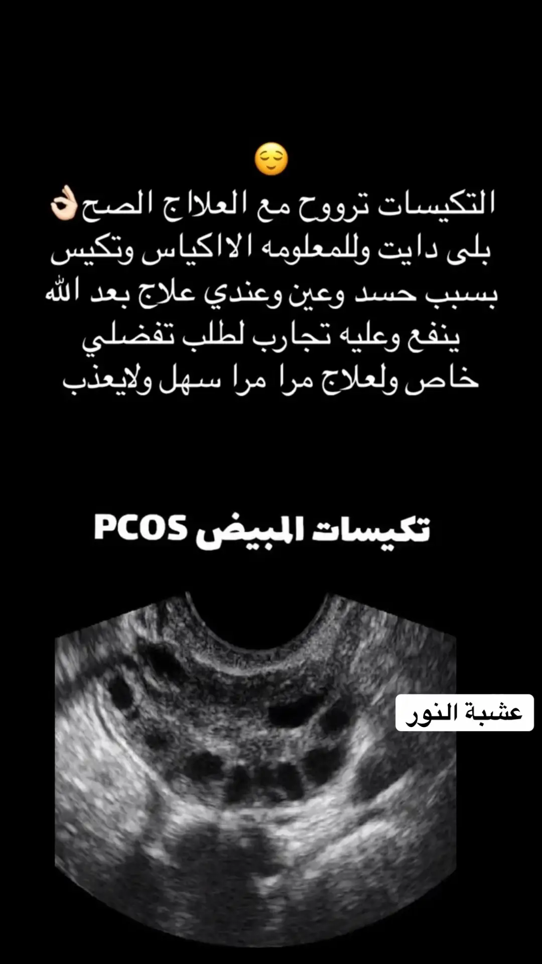 علاج ازالة التكيسات وتنشيط المبايض وتنظيم الهرمونات والدورة مدت الكورس شهرين الى ٣ اشهور#ربي_لاتذرني_فردا_وانت_خير_الوارثين #سورةالبقرة #اكسبلور #السعودي 