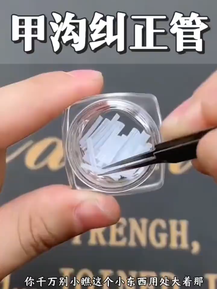 #甲沟炎矫正器 到底谁发明的这个小东西，小小的一个贴上不影响穿鞋穿袜子#足部护理 #实用好物