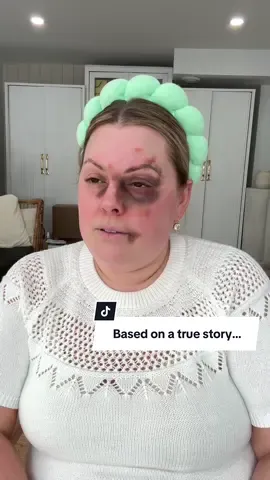 Based on a true story… The bridal black eye, do you carry colour correction in your makeup kit? @Huda Beauty  #weddingtiktok #bridalmakeup #bridalmakeupartist 