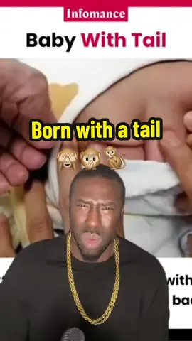 Born with a tail #tail #tailbone #charlesdarwin #xmen #mutant 