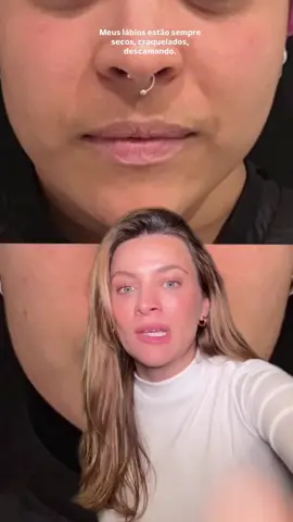 Meus queridinhos: -fenty beauty lip mask - perfeita, zero defeitos - laneige lip mask - Vaseline lábios - aquaphor lábios #dermatologist #dermatologia #lábios #envelhecimento 