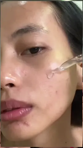 #คอปเปอร์ไตรเปปไทด์  #รูขุมขนกว้าง #skiinestcoppertrypeptg #หลุมสิว 