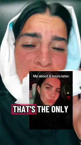 Wisdom teeth have been removed from the chat #fyp #wisdomteeth #foryou 