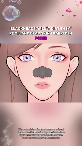 Why You Should NEVER Squeeze Blackheads Again! #skincarefacts #blackheads #pores #skintips #clearskin