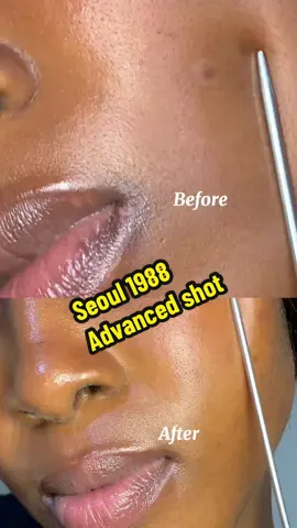 #ksecret #seoul1988 #retinal #shot #wrinklecare @KSECRET GLOBAL 