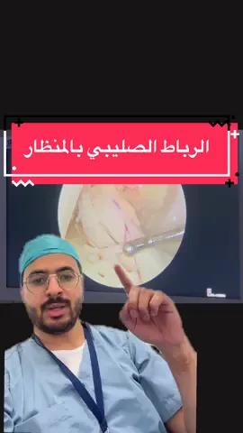 شكل الرباط الصليبي الأمامي المقطوع؛ وبعد الزراعة!! #جراحة_العظام  #جراحة_الإصابات_الرياضية  #الدمام_الخبر_الشرقيه #الرباط_الصليبي #الإصابات_الرياضية #مستشفى_الحبيب #منظار 