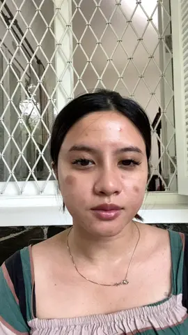 Yuk buuruan checkout sekarang juga !!#amurabeautycare 