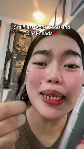 #stainlesssteel #stainless #tools #acne #blackheads 