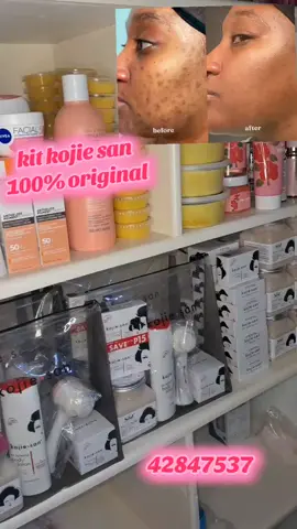 42847537 Kojie San a pour principaux effets d'éclaircir le teint, de réduire les taches brunes, les cicatrices d'acné, et l'hyperpigmentation, tout en rendant la peau plus lisse, douce et lumineuse. Il agit grâce à l'acide kojique, un ingrédient qui freine la production de mélanine. Son utilisation quotidienne peut également nettoyer la peau en profondeur et la hydrater #viralvideo #kojiesan 