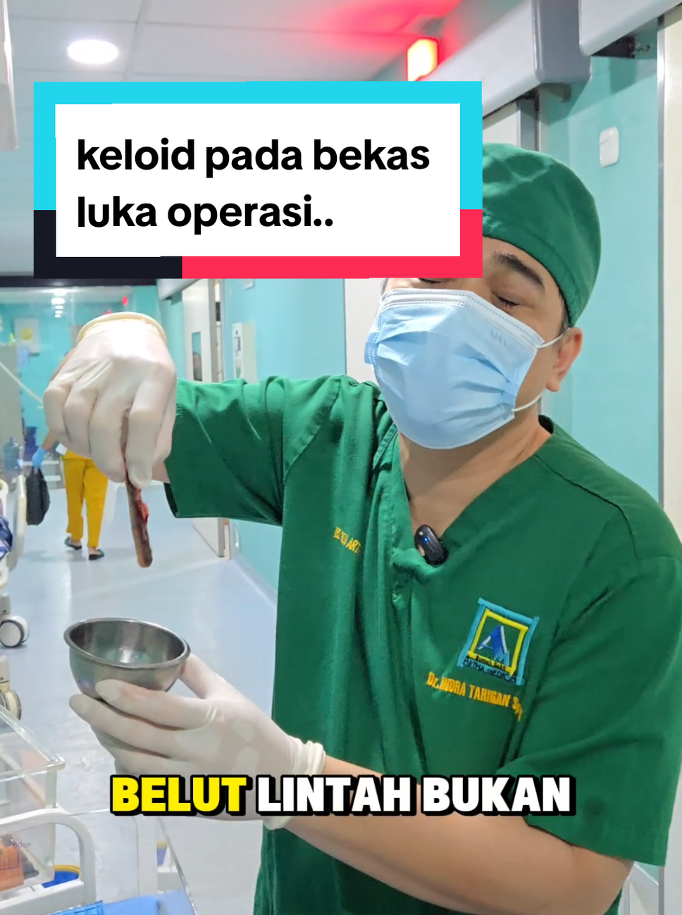 🩹 Cara Mencegah Keloid Setelah Operasi SC 1️⃣ Jaga luka tetap bersih & kering. 2️⃣ Hindari garukan atau tekanan pada bekas luka. 3️⃣ Gunakan salep/krim silikon sesuai anjuran dokter. 4️⃣ Lindungi dari sinar matahari langsung. 5️⃣ Bila riwayat keloid, konsultasikan sebelum operasi ya Bun. 📹 Diunggah dengan persetujuan tertulis pasien & keluarga. @pengikut silakan share bila berkenan ya #drIndraTariganSpOG #LukaSC #IbuPascaMelahirkan #Keloid