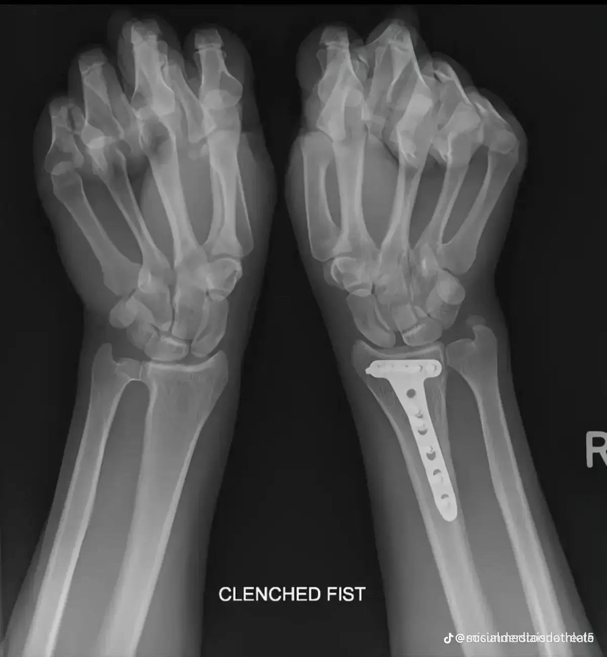 😤 drop your flic ⬇️