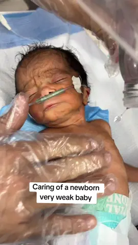 #EmClimaUltraLeve  #unfreezmyaccount #veryweakbaby #newborn 